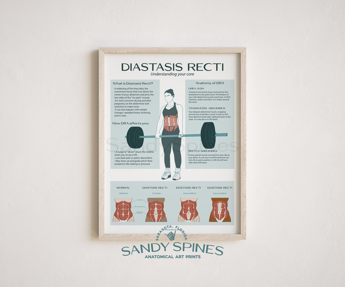 Diastasis Recti Anatomy | Postpartum Poster