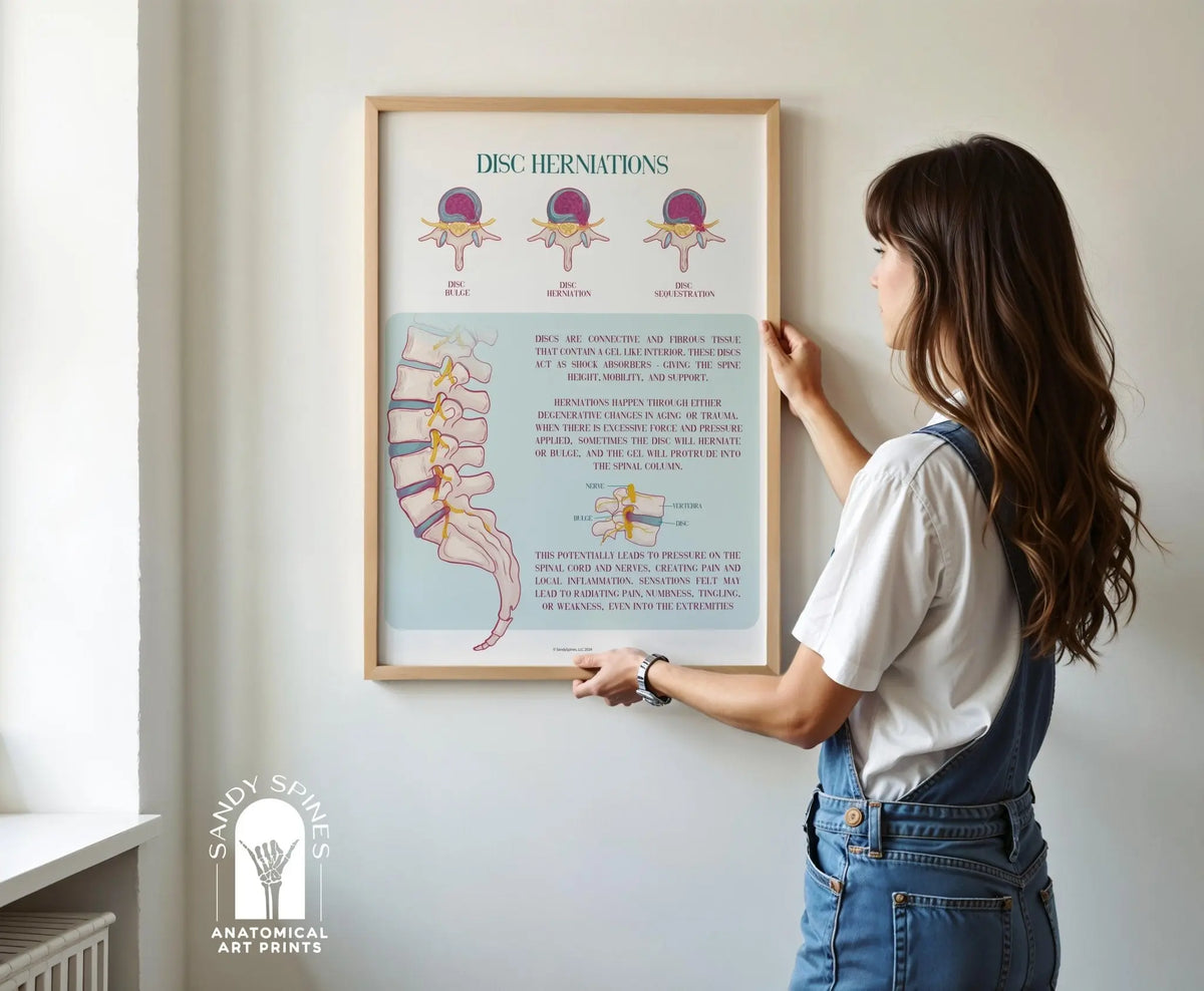 chiropractor holding up Disc Herniation Poster