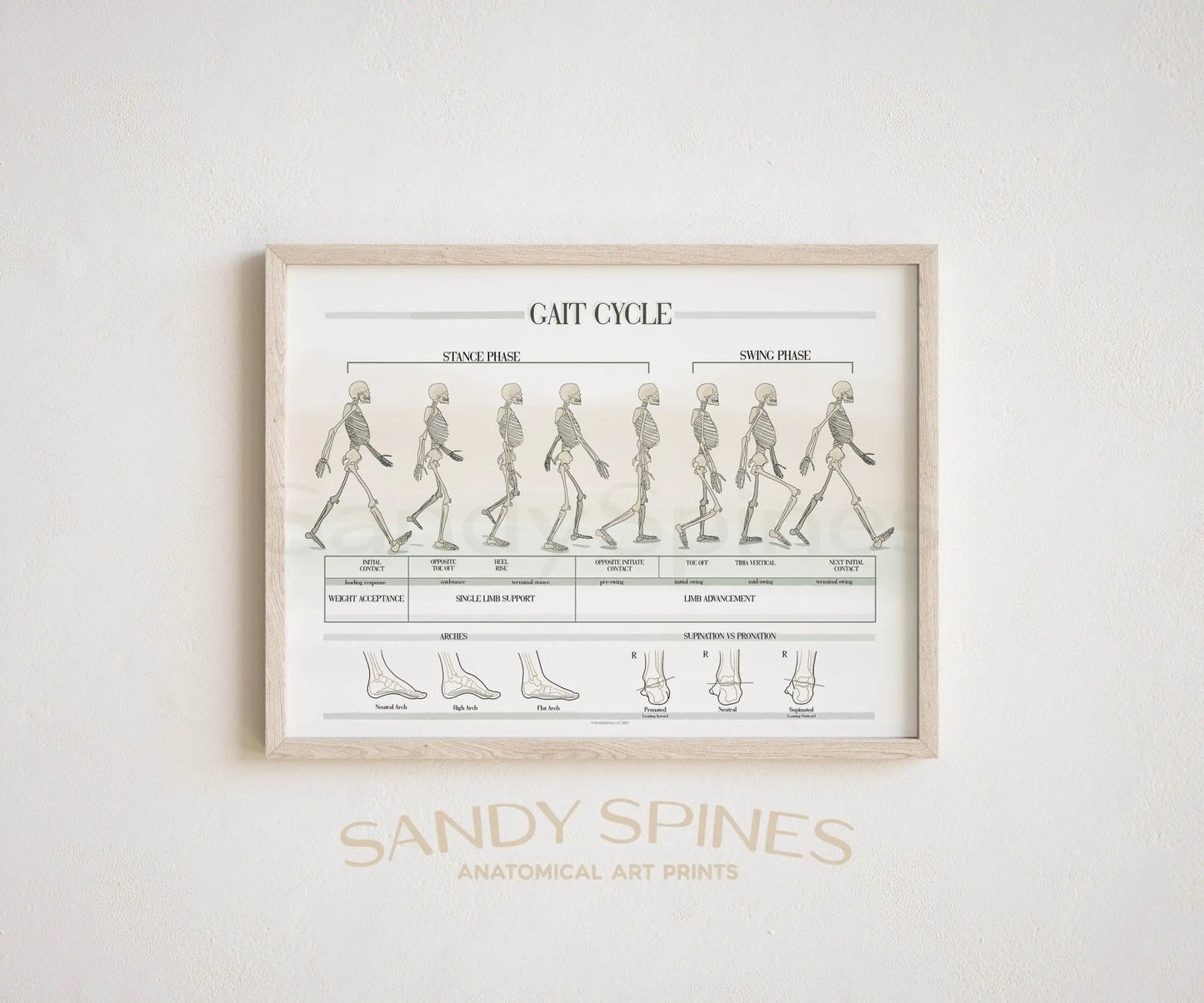 Gait Analysis Poster - SandySpines