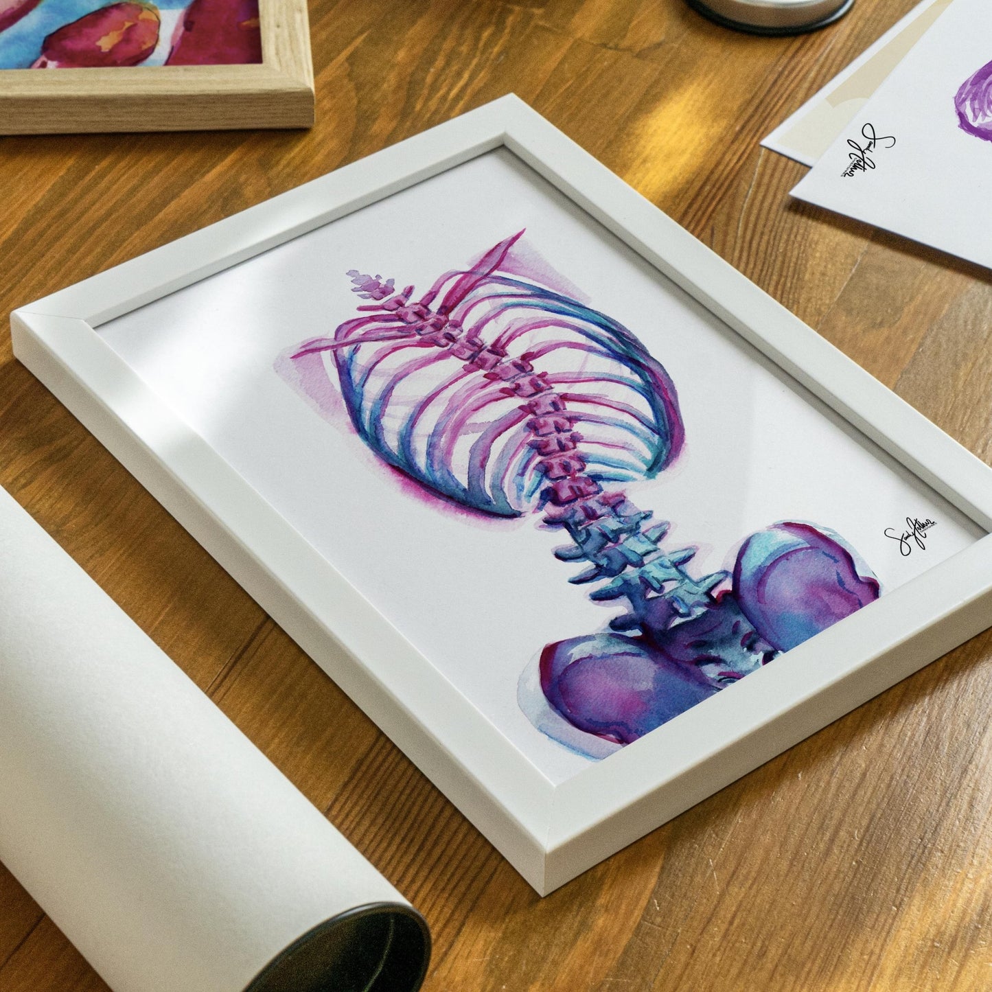 Scoliosis Abstract Print - SandySpines