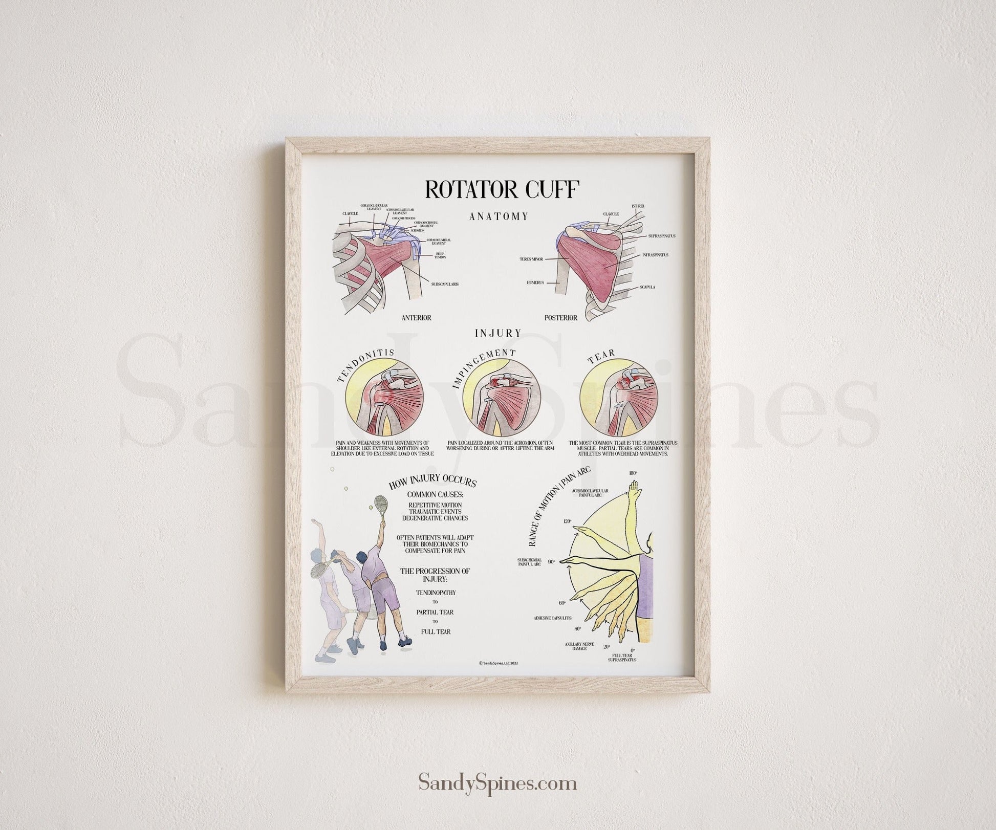 Shoulder Rotator Cuff Anatomy and Injury Poster - SandySpines