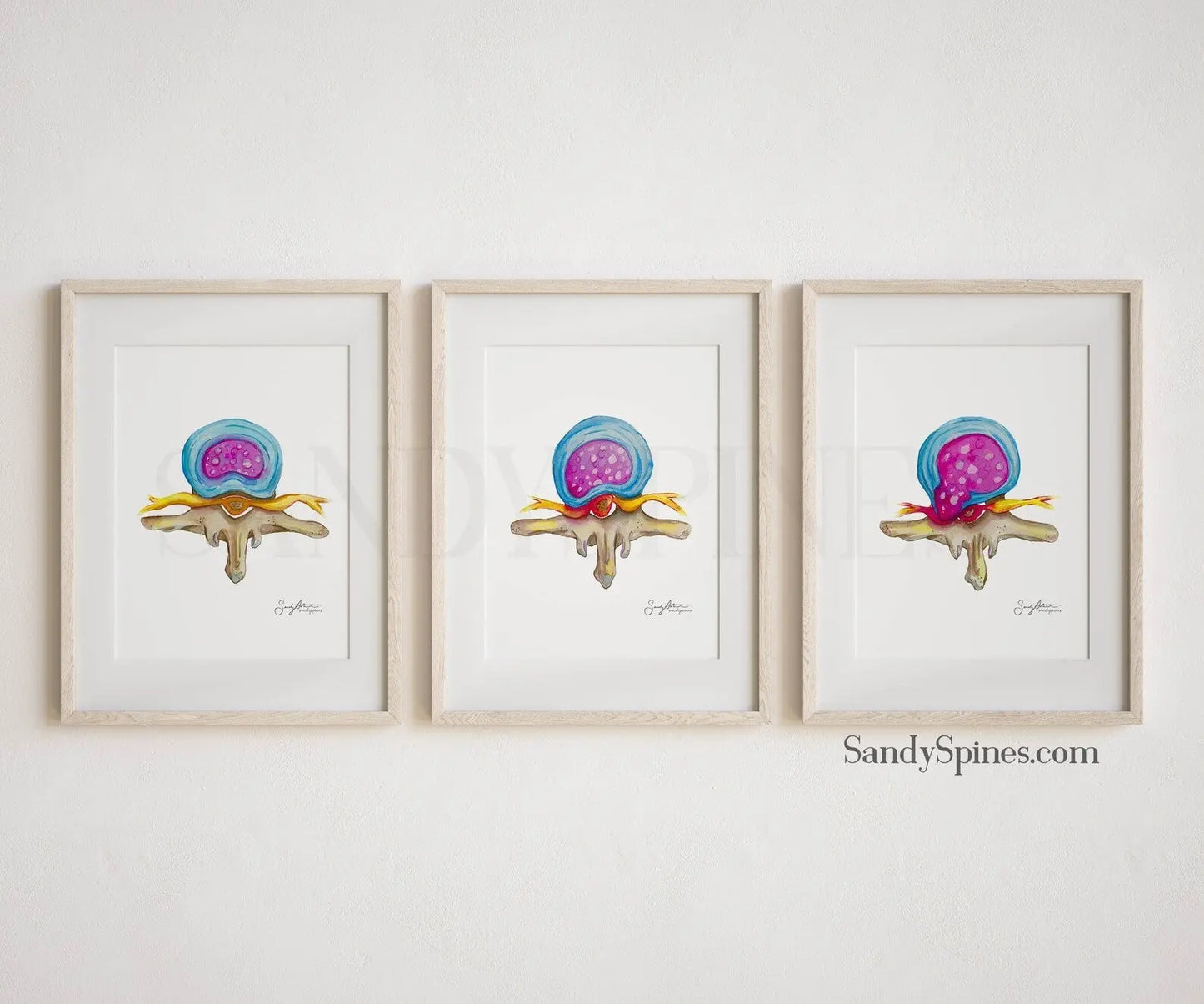 Spinal Disc Anatomy Watercolor Prints (Three) - SandySpines