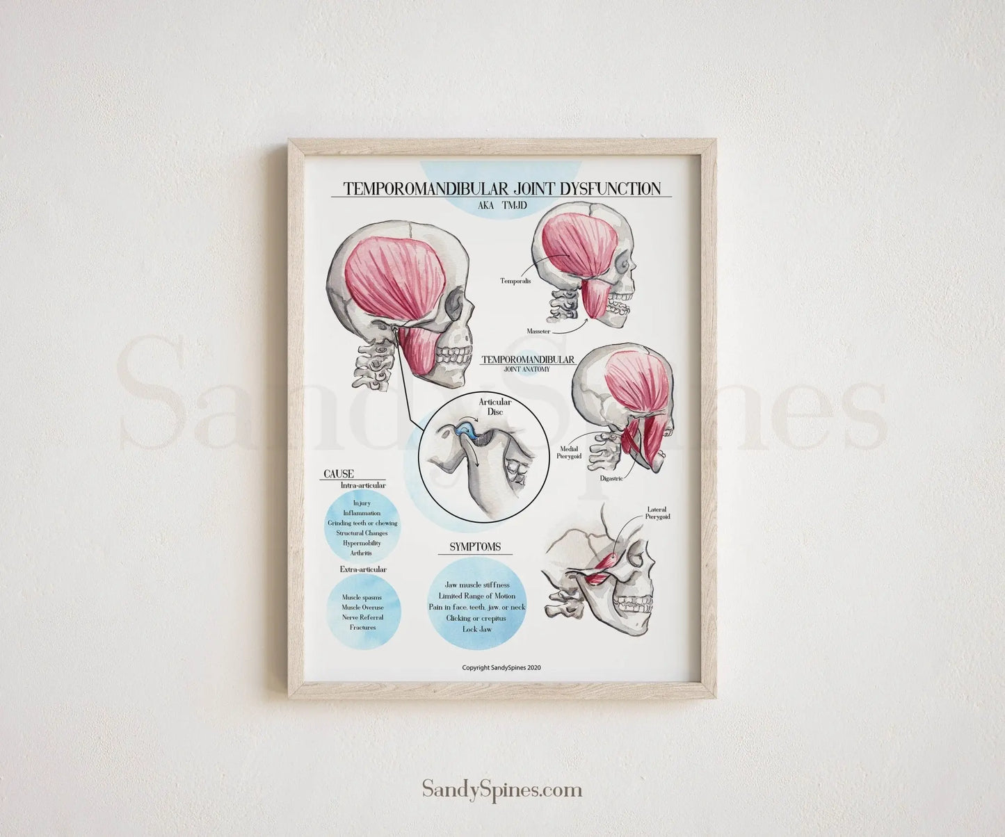 TMJD | Temporomandibular Joint Dysfunction Poster - SandySpines