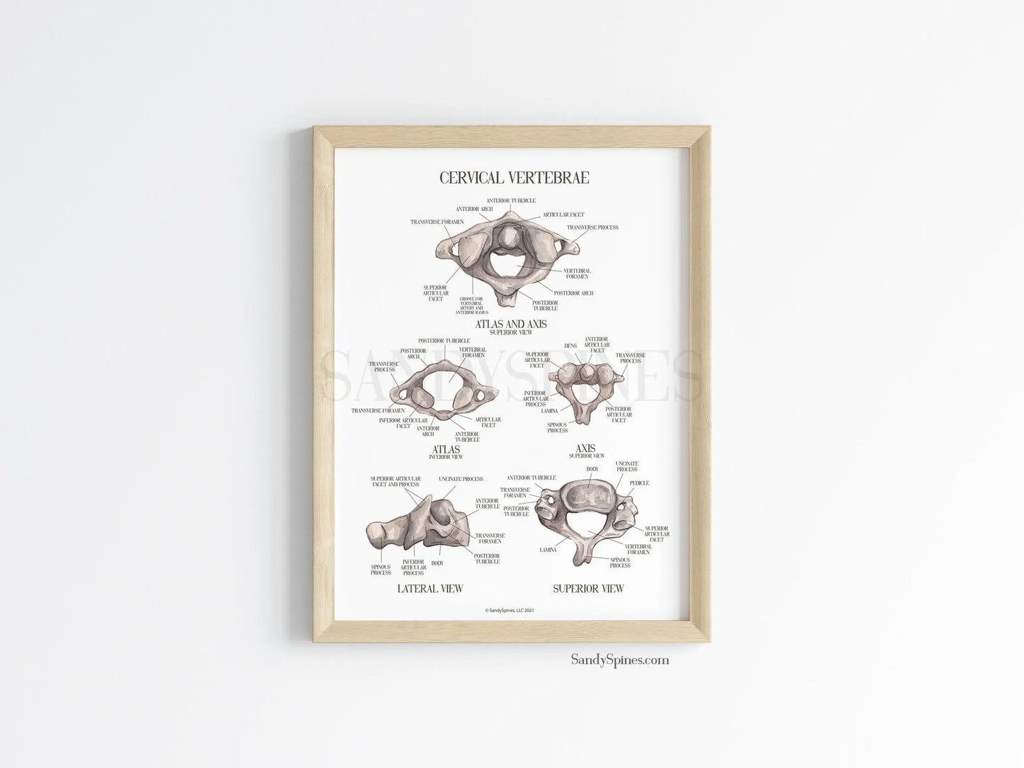Cervical Vertebra Labeled Poster - SandySpines