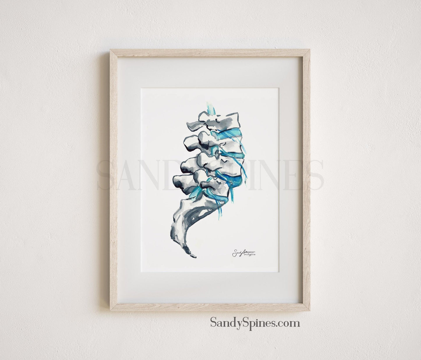 Degeneration Spine Print - SandySpines