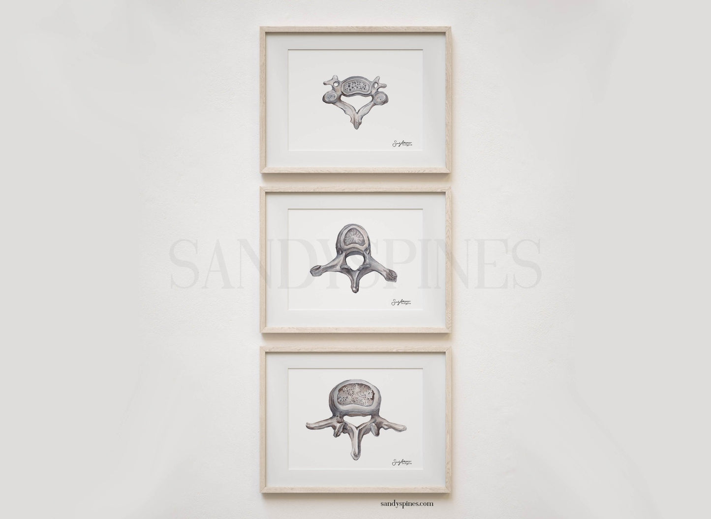 Grayscale Trio of Vertebrae | Cervical, Thoracic, Lumbar | 3 Prints - SandySpines