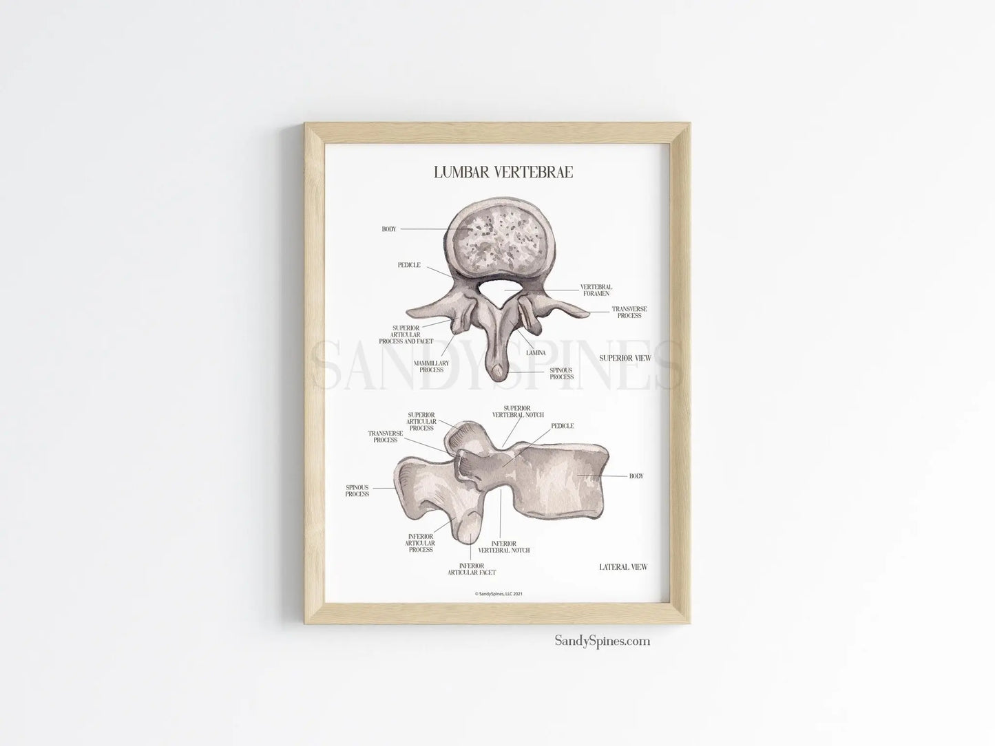 Lumbar Vertebra Labeled Poster - SandySpines