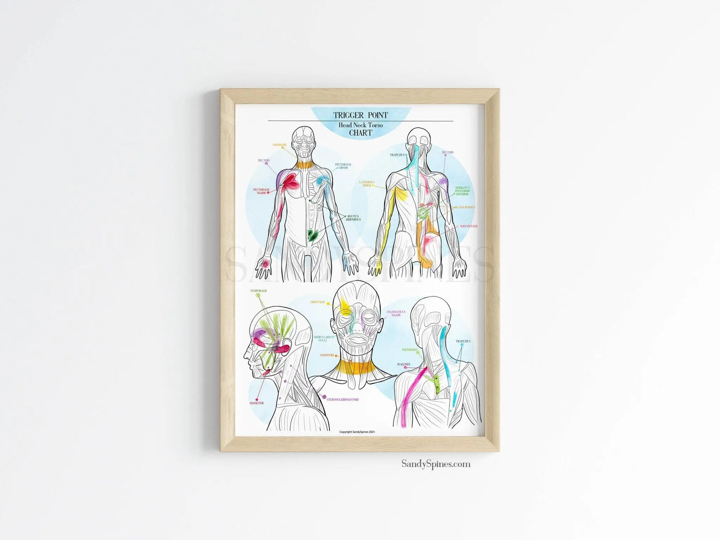Trigger Point Charts | Body/Head/Torso Chart - SandySpines