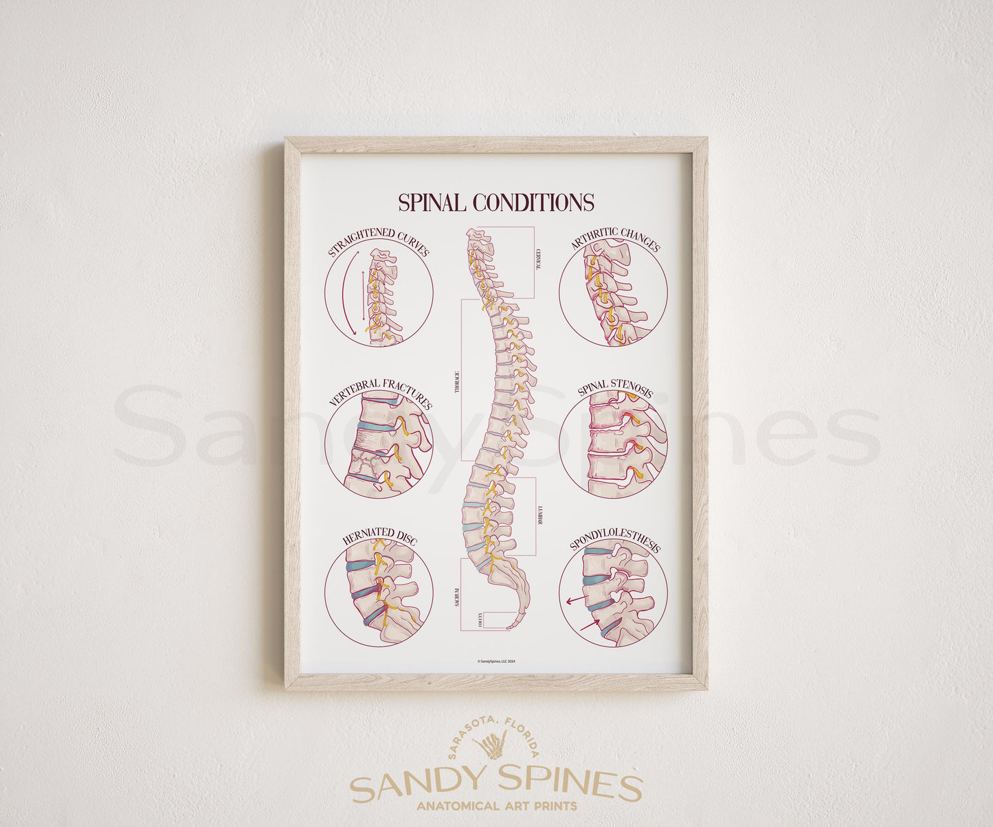 Spinal Conditions Poster
