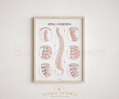 Spinal Conditions Poster