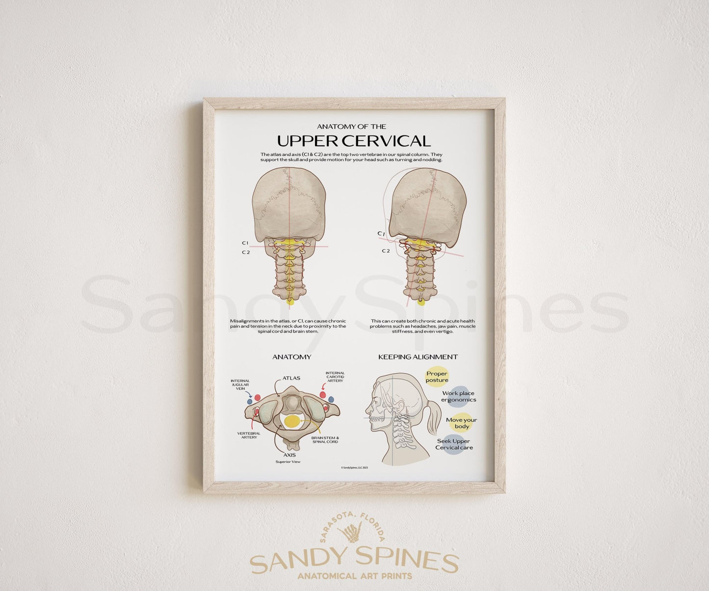 Anatomy of the Upper Cervical Poster - SandySpines