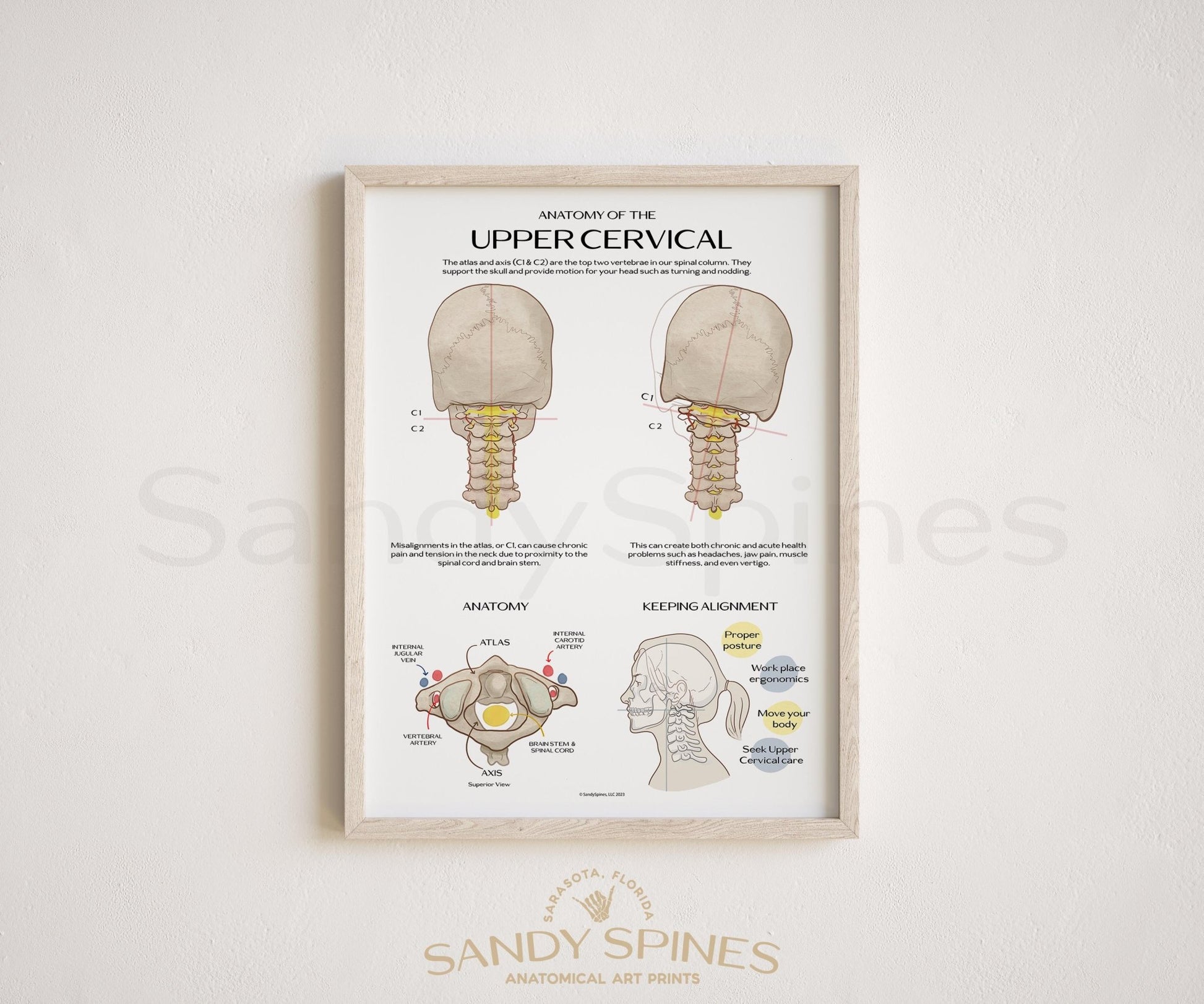 Anatomy of the Upper Cervical Poster - SandySpines