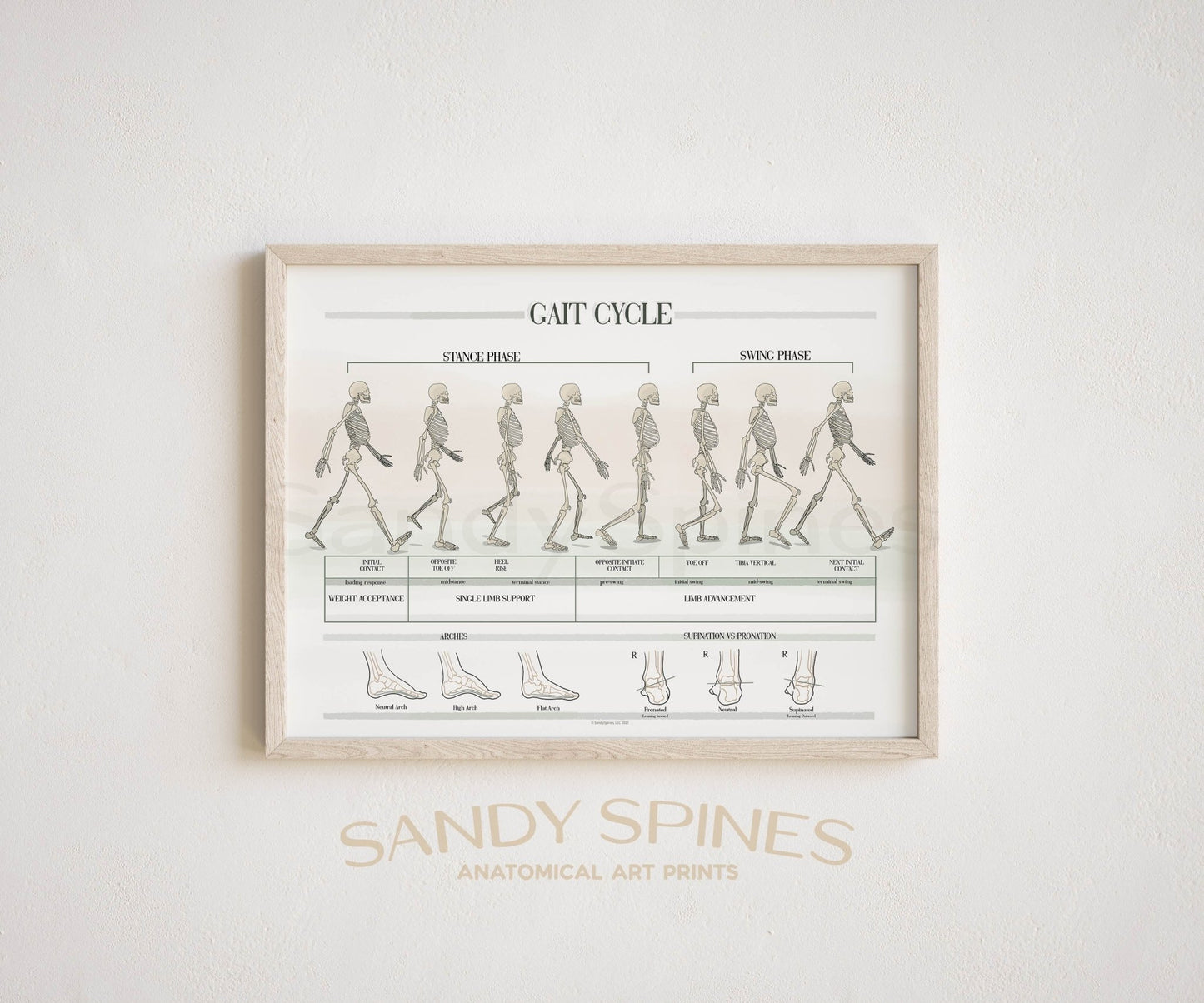 Gait Analysis Poster - SandySpines
