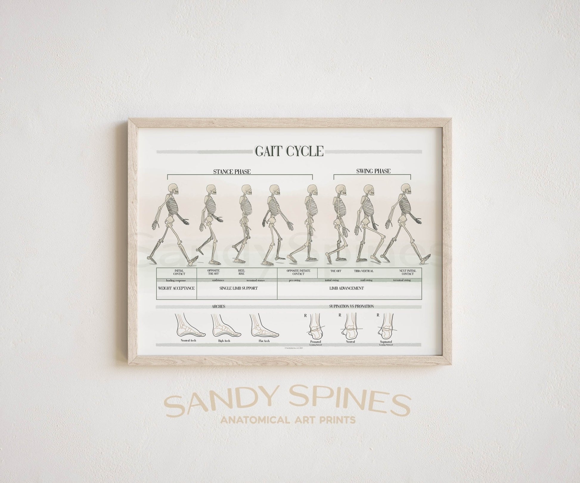 Gait Analysis Poster - SandySpines