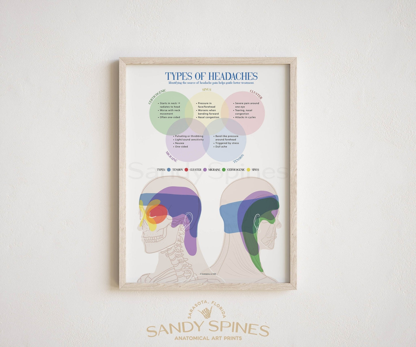 Headache Types Poster - SandySpines