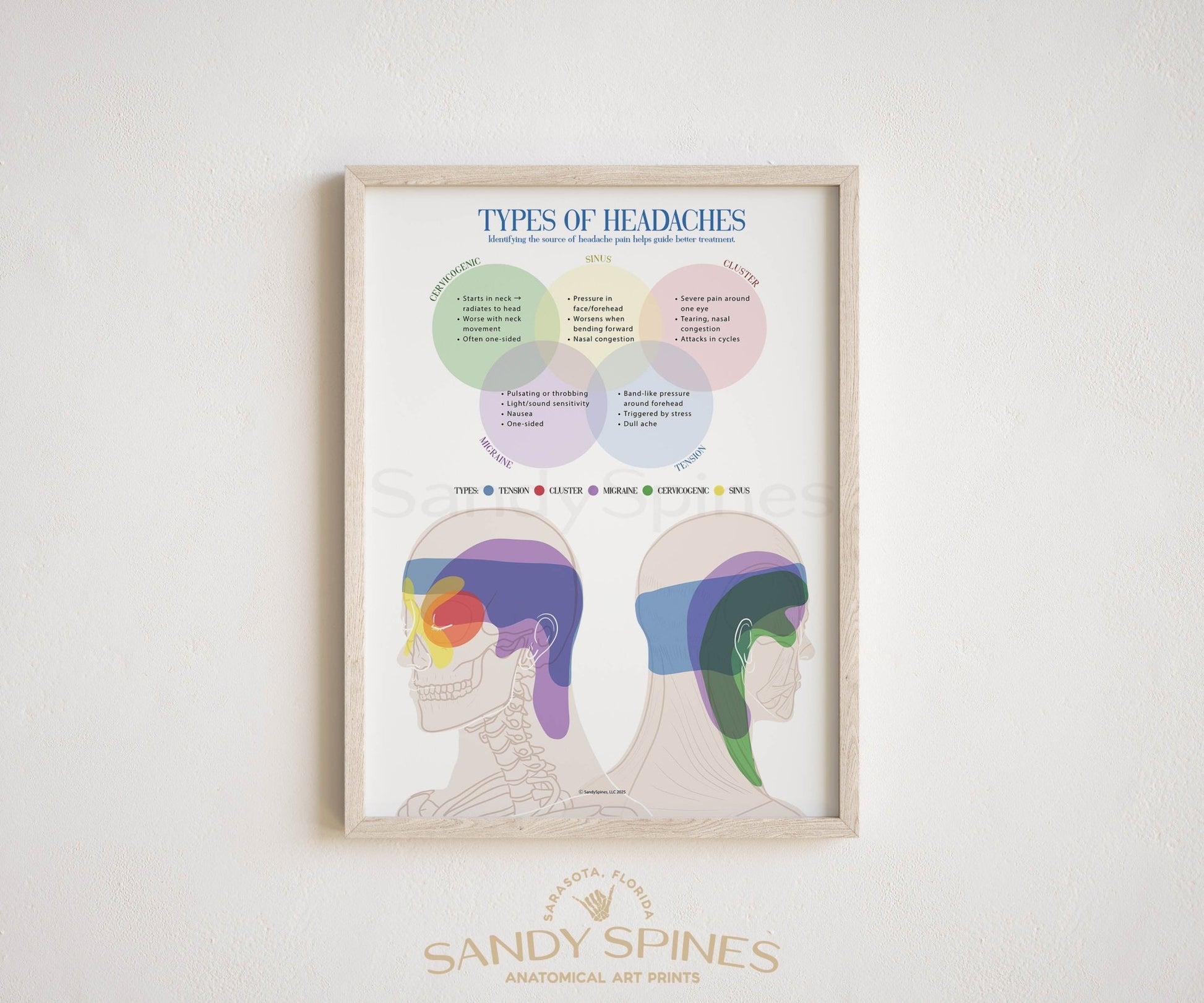 Headache Types Poster - SandySpines