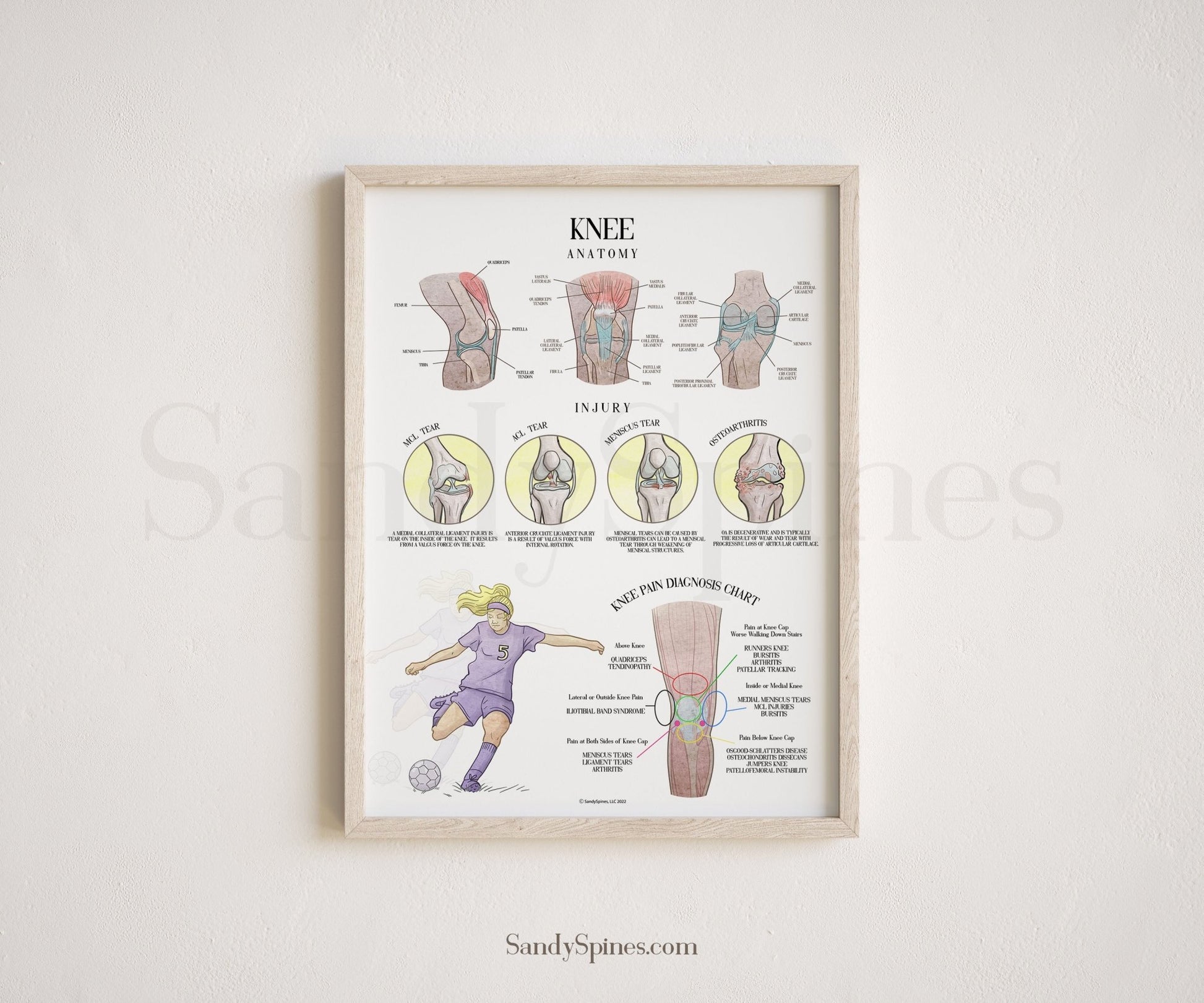 Knee Anatomy and Injury Poster - SandySpines