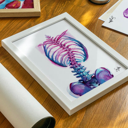Scoliosis Abstract Print