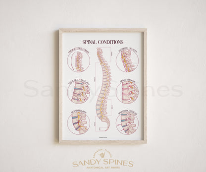 Spine Conditions Poster by SandySpines