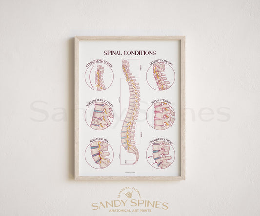 Spine Conditions Poster by SandySpines