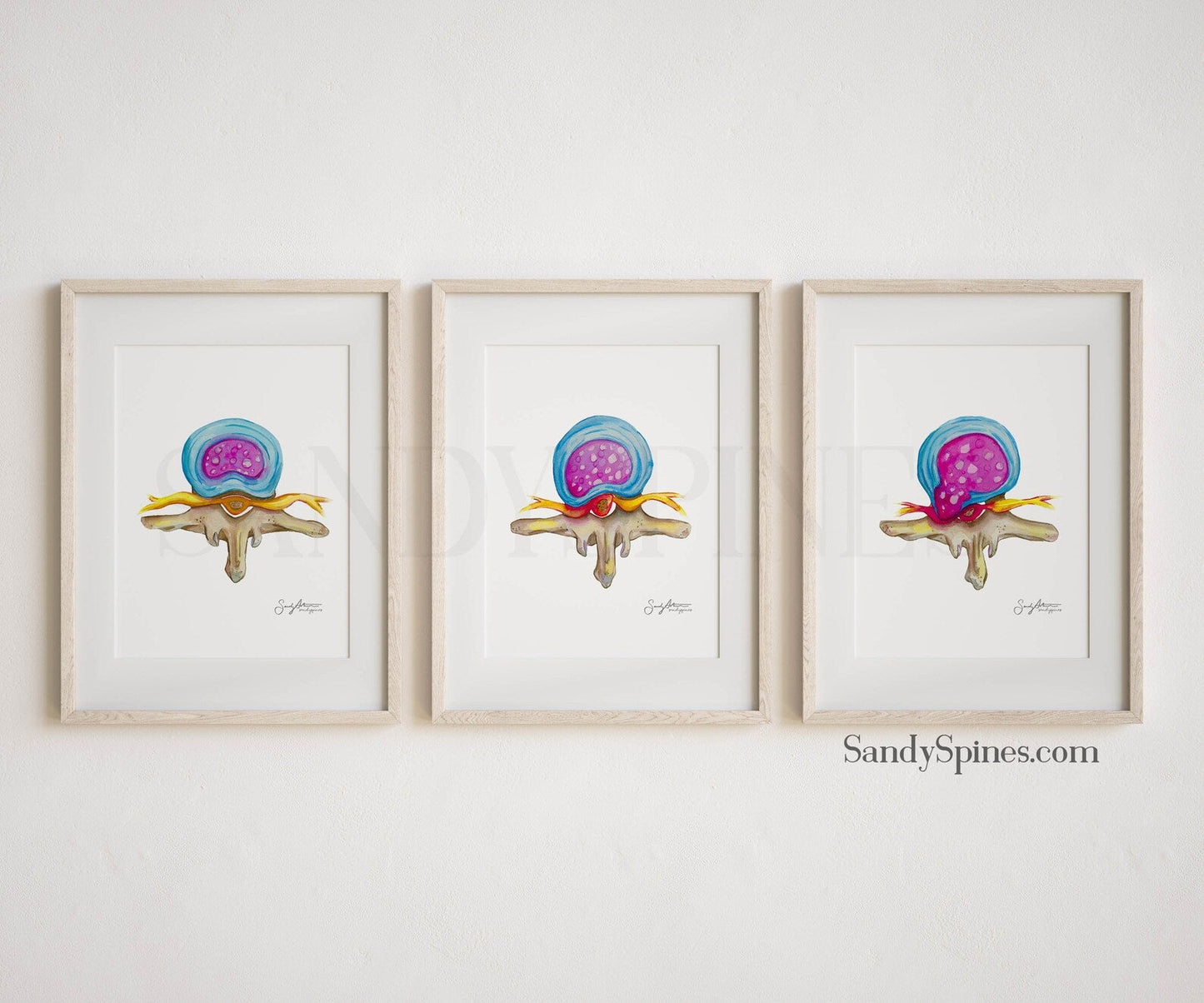 Spinal Disc Anatomy Watercolor Prints (Three) - SandySpines