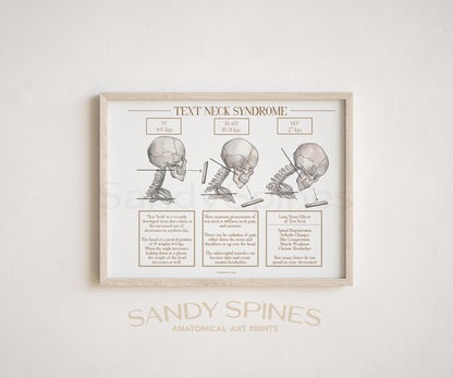 Text Neck Poster - SandySpines