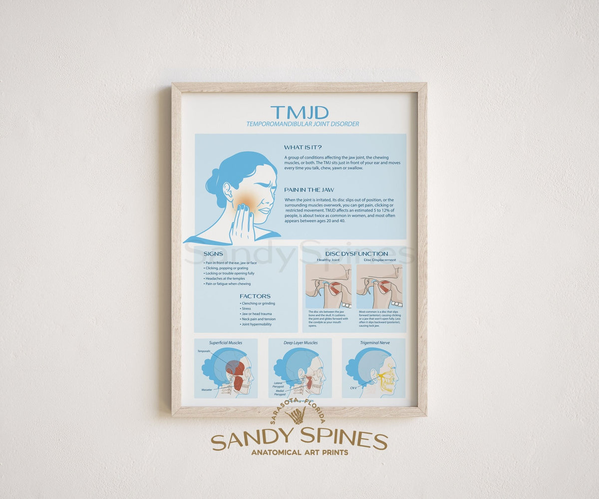 TMJD Temporomandibular Joint Disorder Anatomy Poster - SandySpines