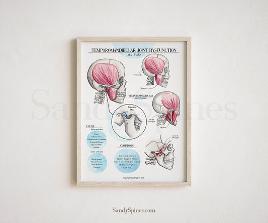 TMJD | Temporomandibular Joint Dysfunction Poster