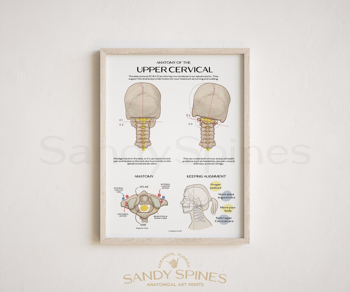 Anatomy of the Upper Cervical Poster