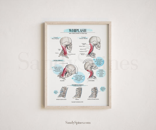 WHIPLASH Educational Poster - SandySpines