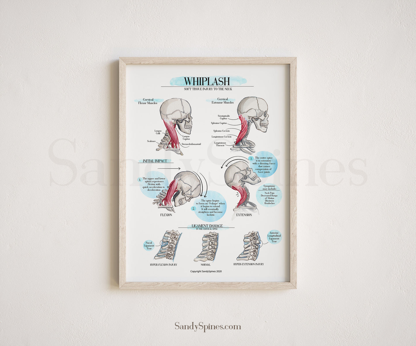 WHIPLASH Educational Poster