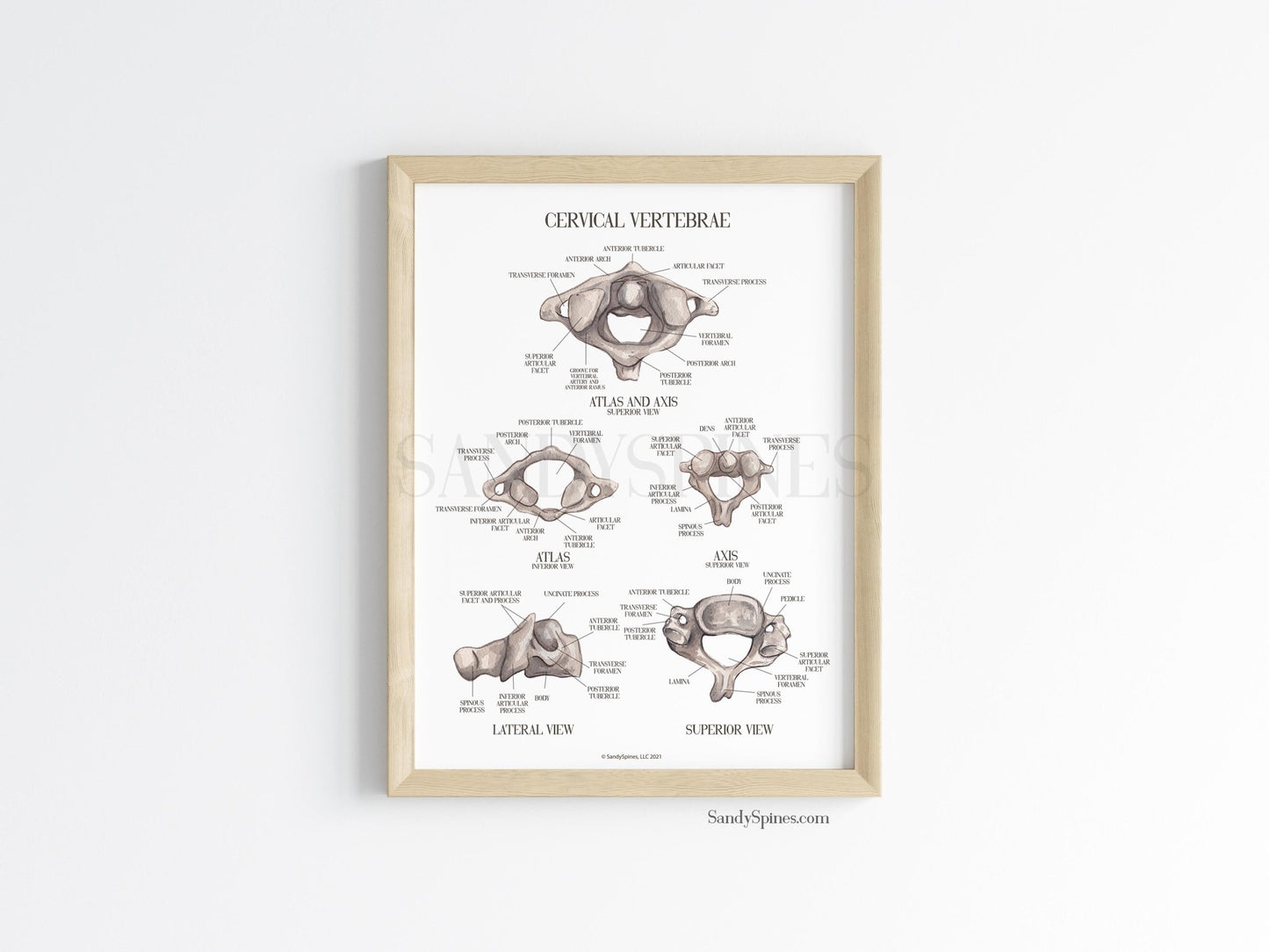 Cervical Vertebra Labeled Poster - SandySpines