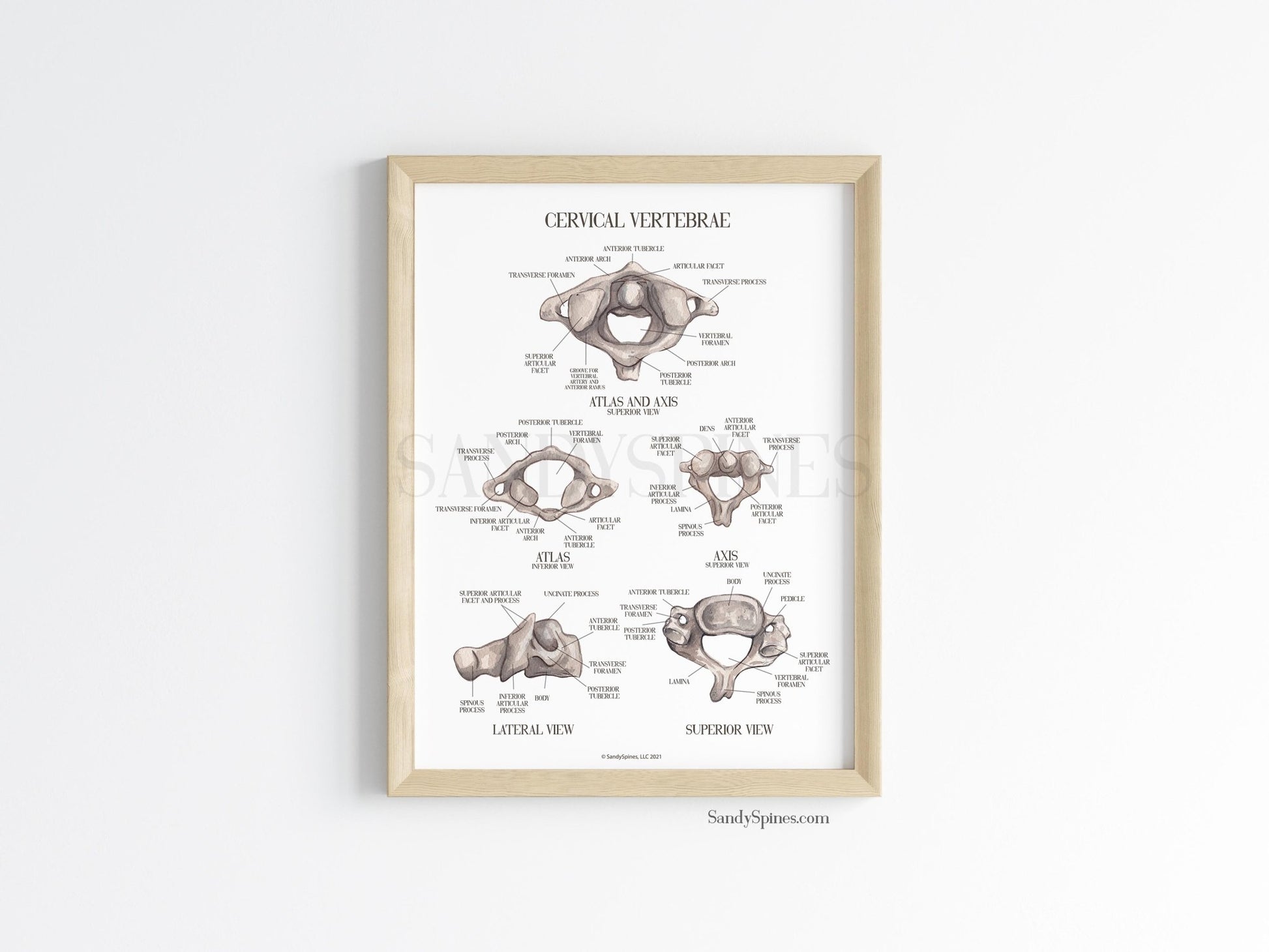 Cervical Vertebra Labeled Poster - SandySpines