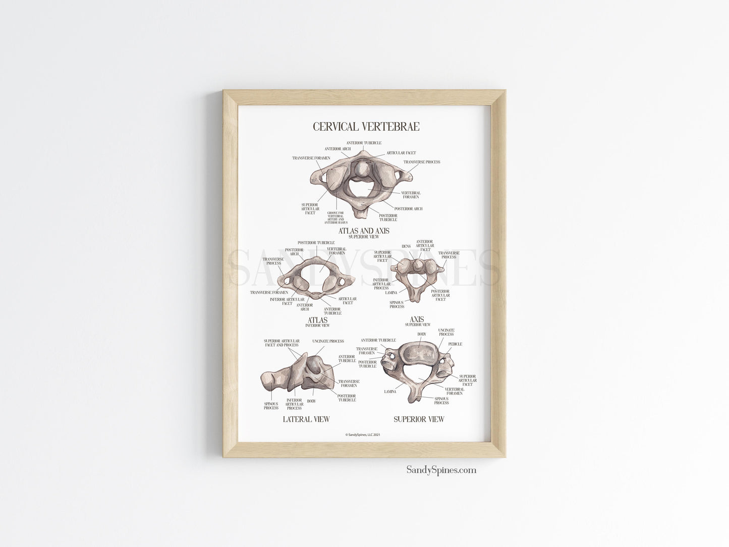 Cervical Vertebra Labeled Poster