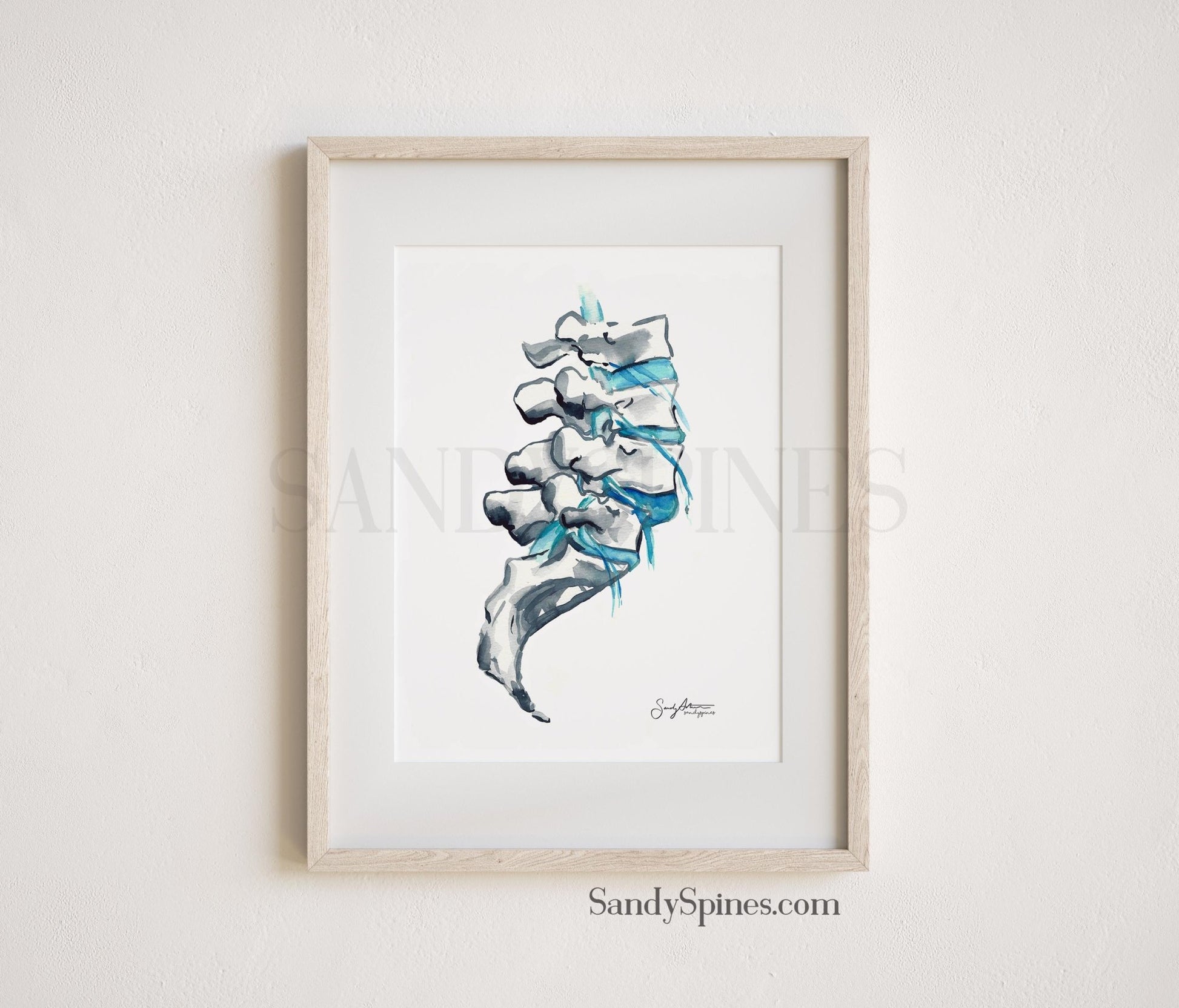 Degeneration Spine Print - SandySpines