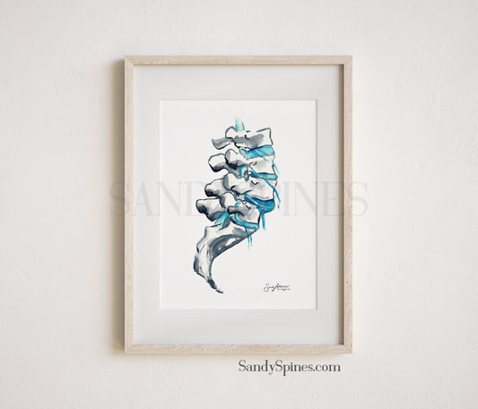 Degeneration Spine Print - SandySpines