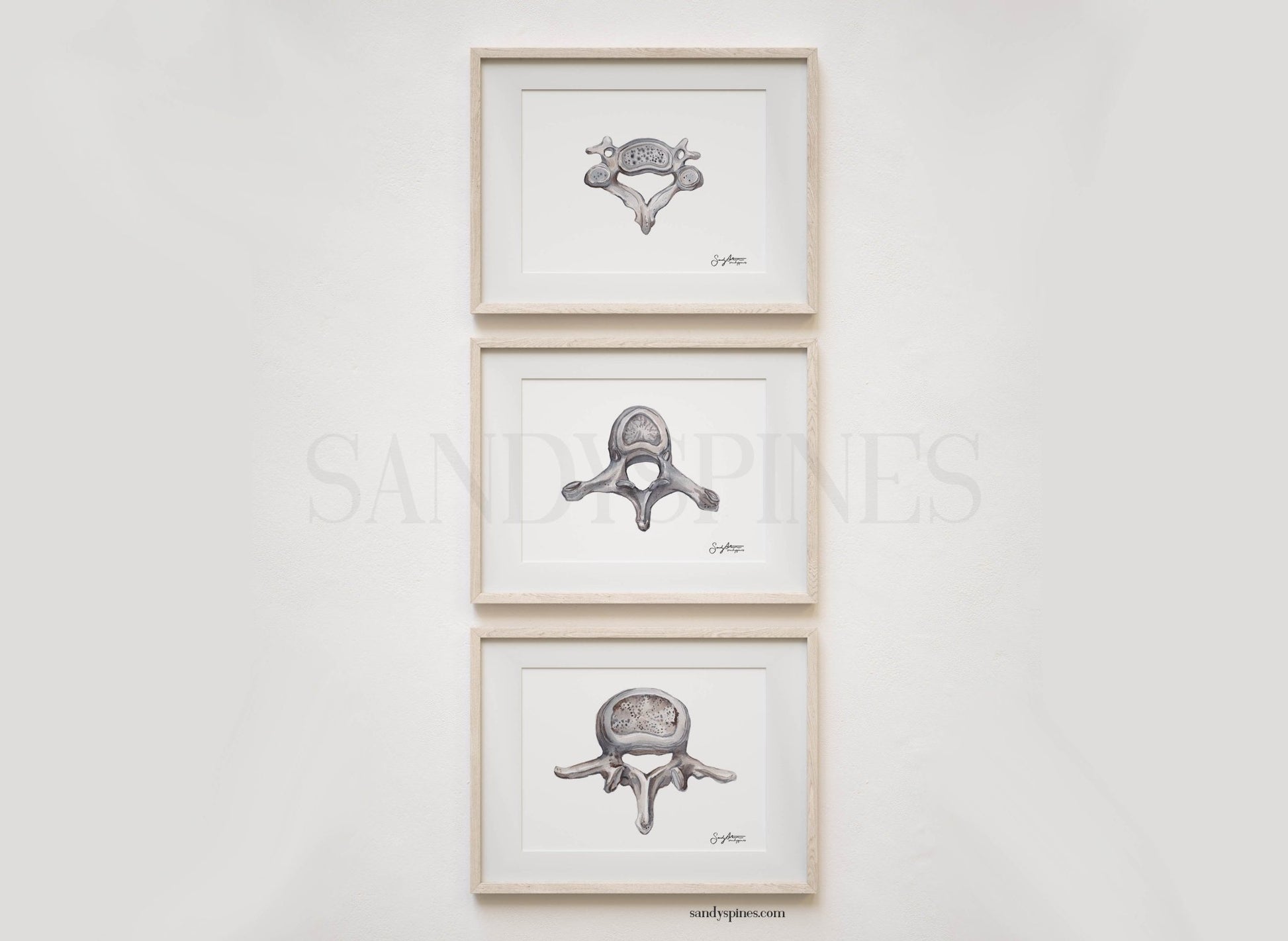 Grayscale Trio of Vertebrae | Cervical, Thoracic, Lumbar | 3 Prints - SandySpines