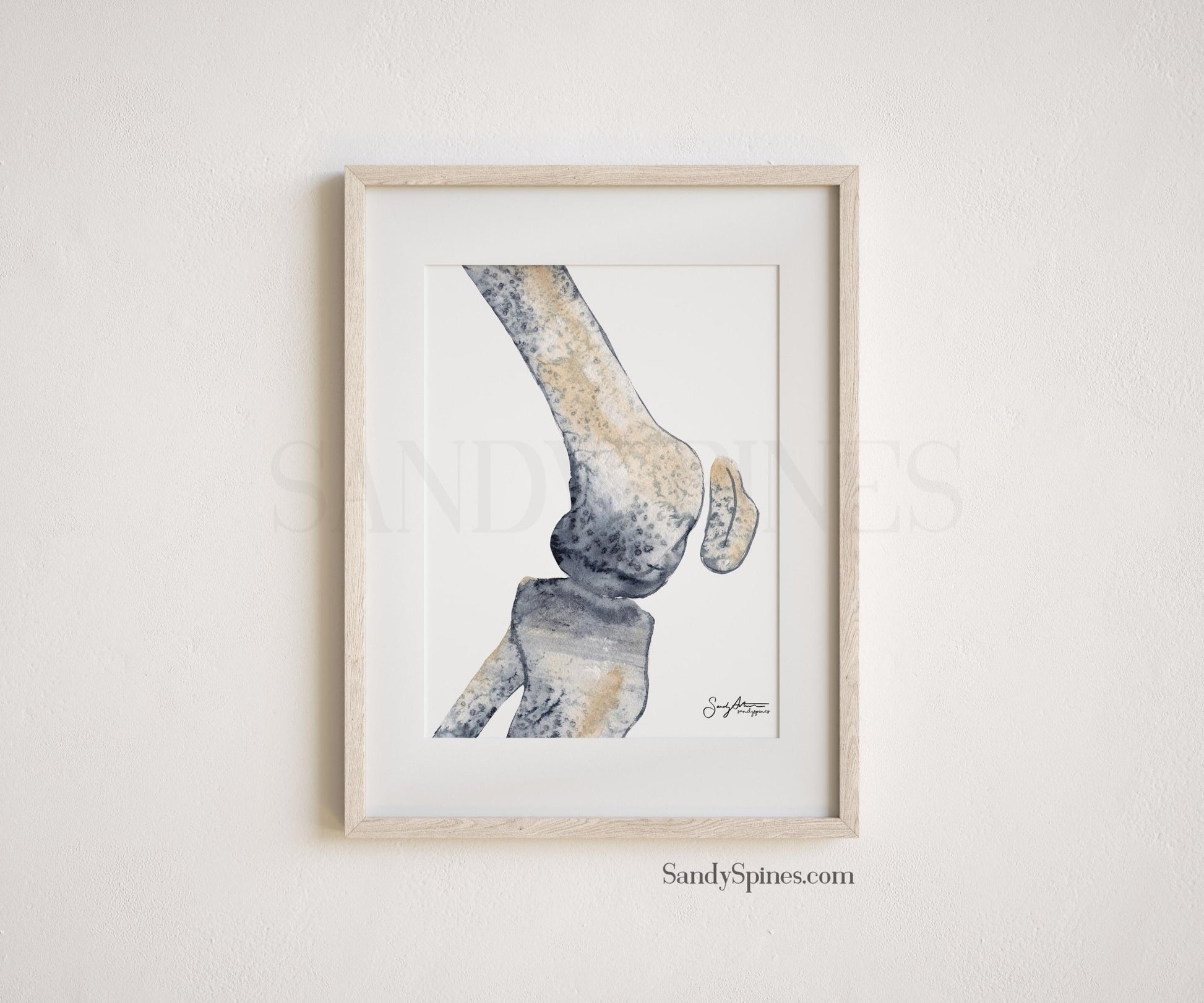 Knee Radiograph Watercolor Set of Prints - SandySpines