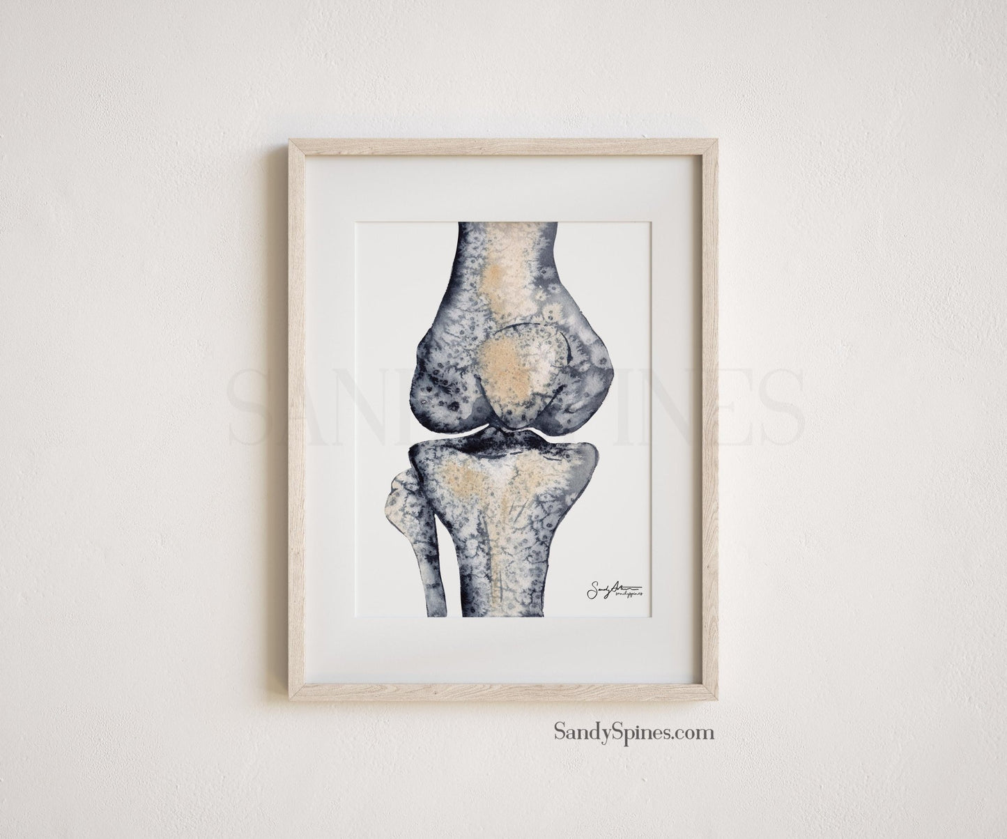 Knee Radiograph Watercolor Set of Prints - SandySpines