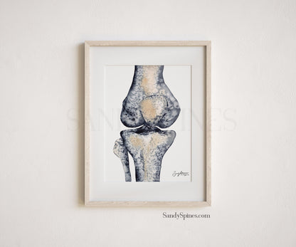 Knee Radiograph Watercolor Set of Prints - SandySpines