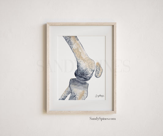 Knee Radiograph Watercolor Prints (2)