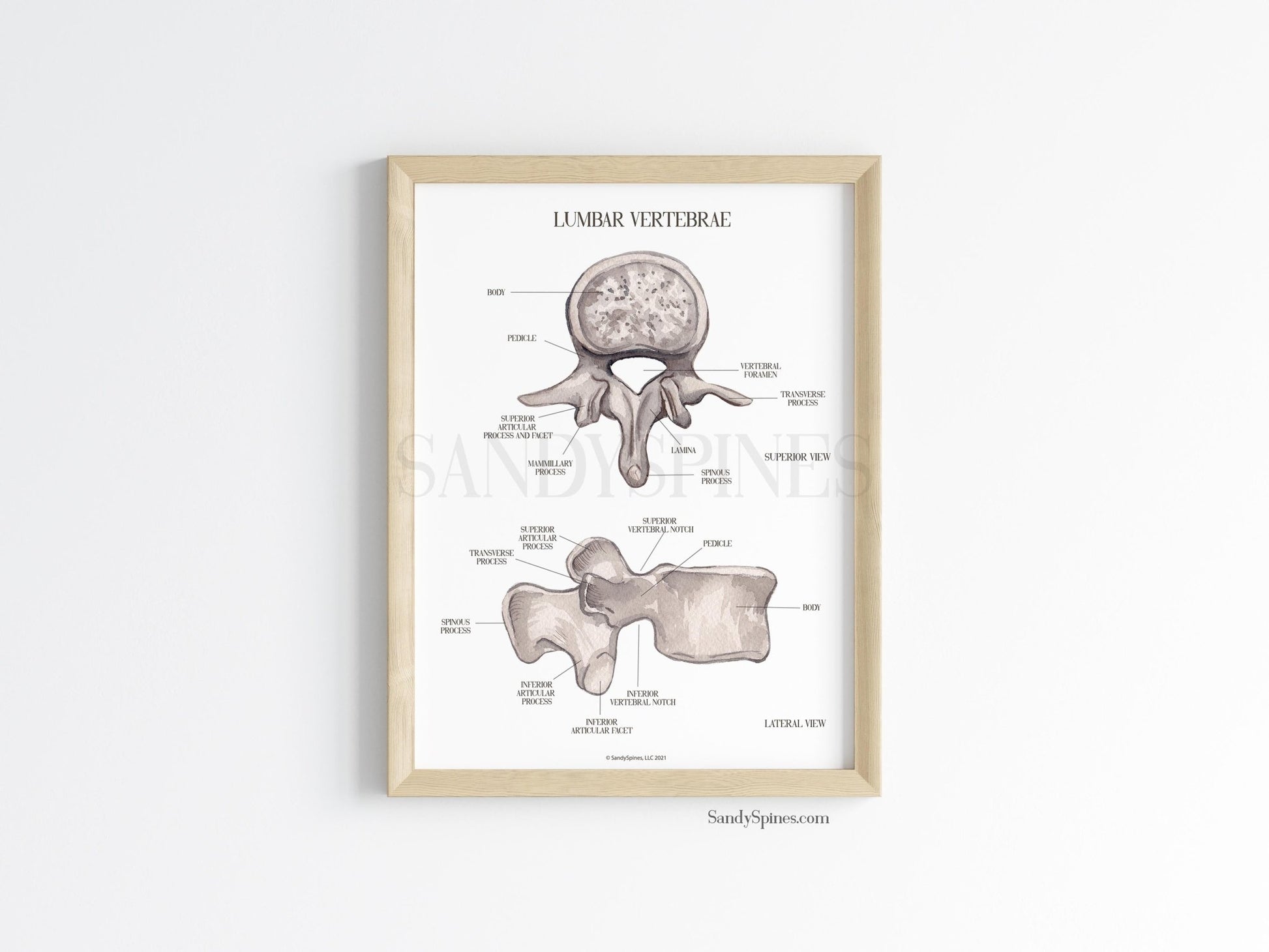 Lumbar Vertebra Labeled Poster - SandySpines