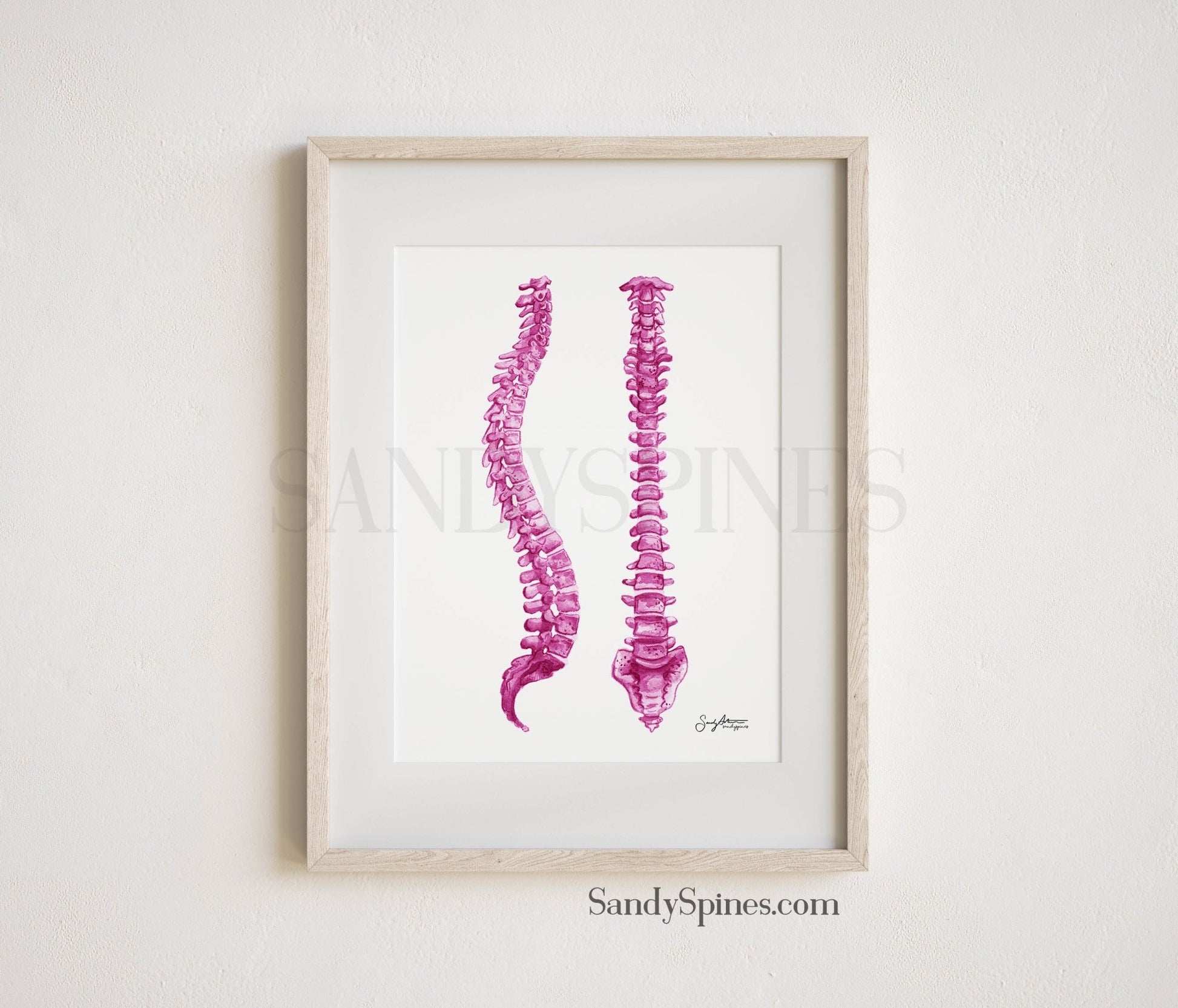 Pink Spines Print - SandySpines