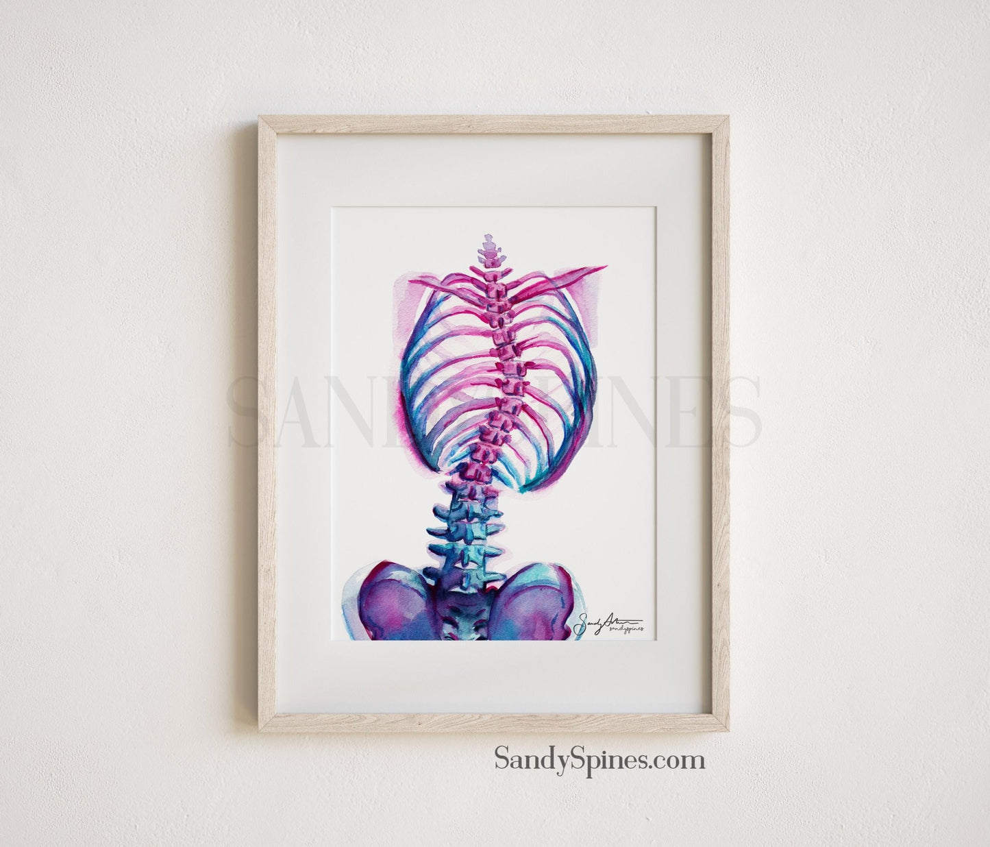 Scoliosis Abstract Print - SandySpines