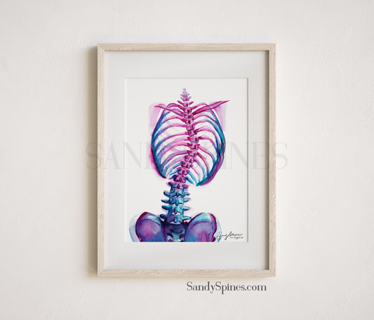 Scoliosis Abstract Print