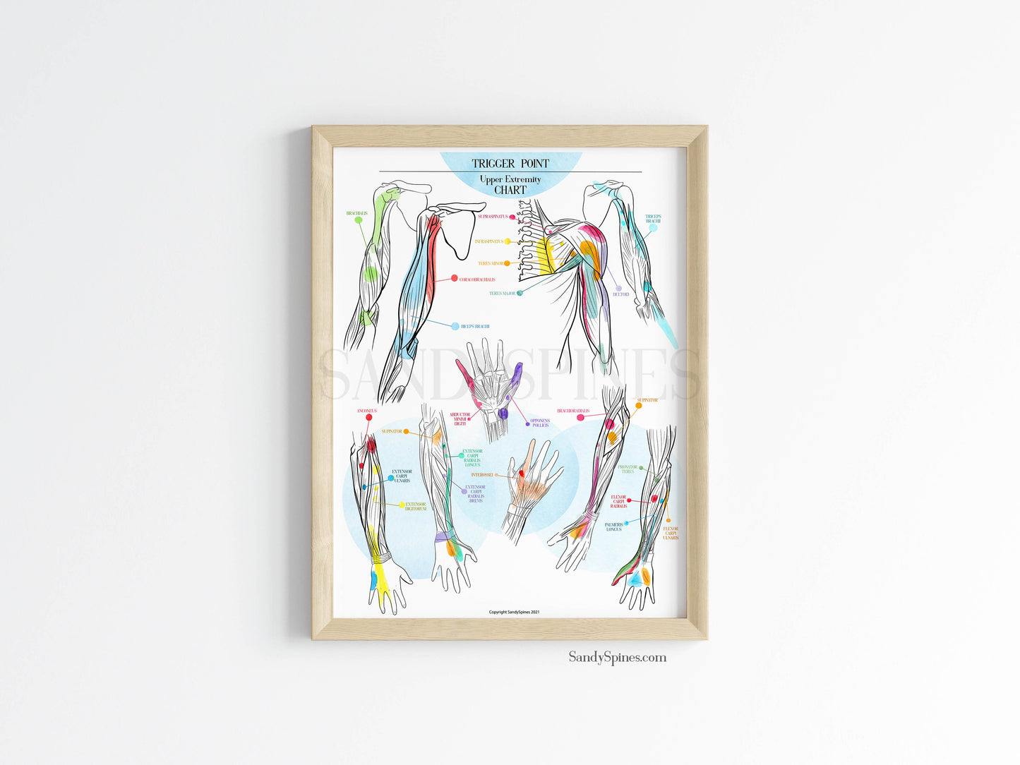 Trigger Point Charts | Set of 3 Posters
