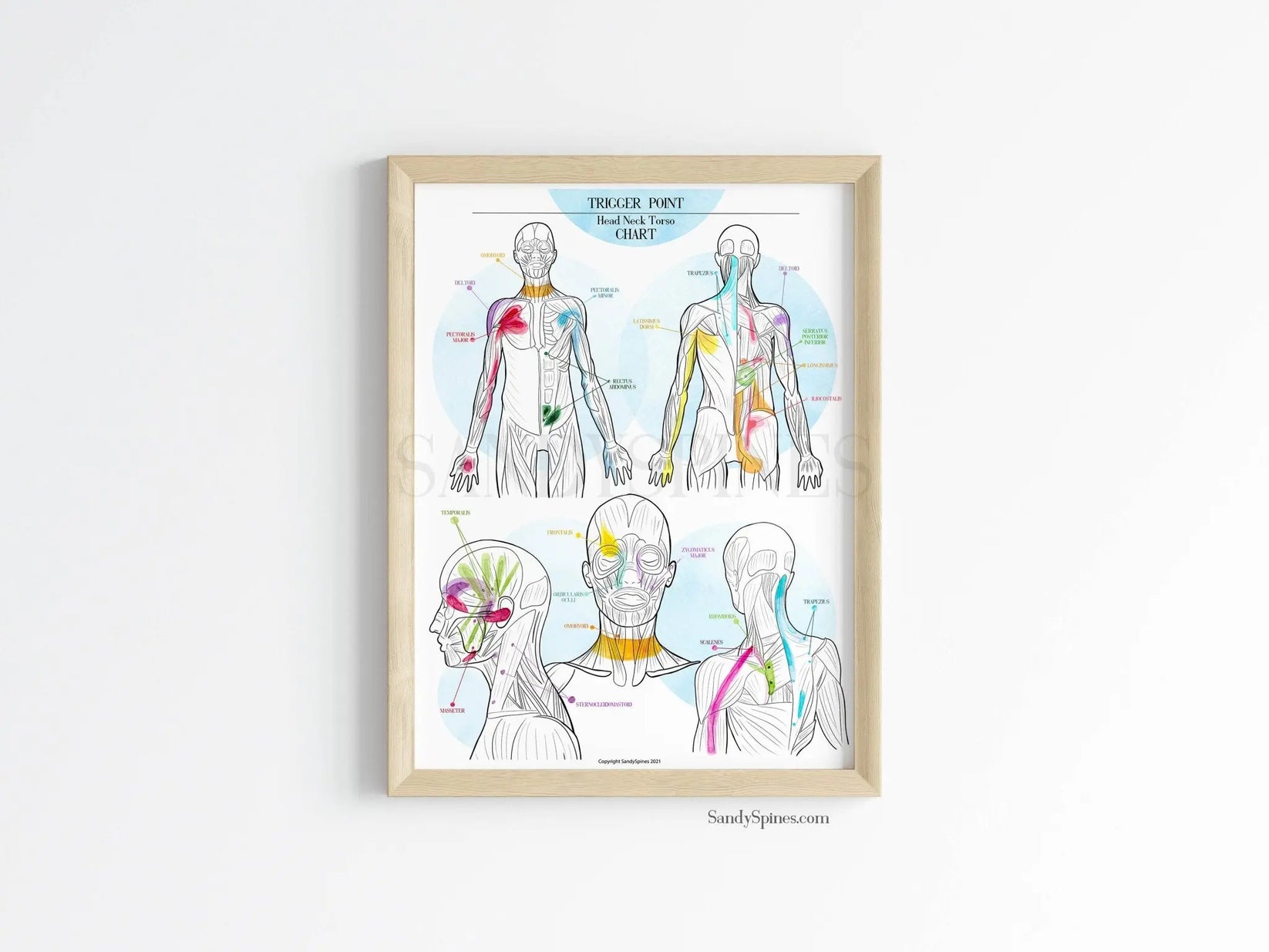 Trigger Point Body/Head/Torso Chart for Chiropractors & PTs SandySpines