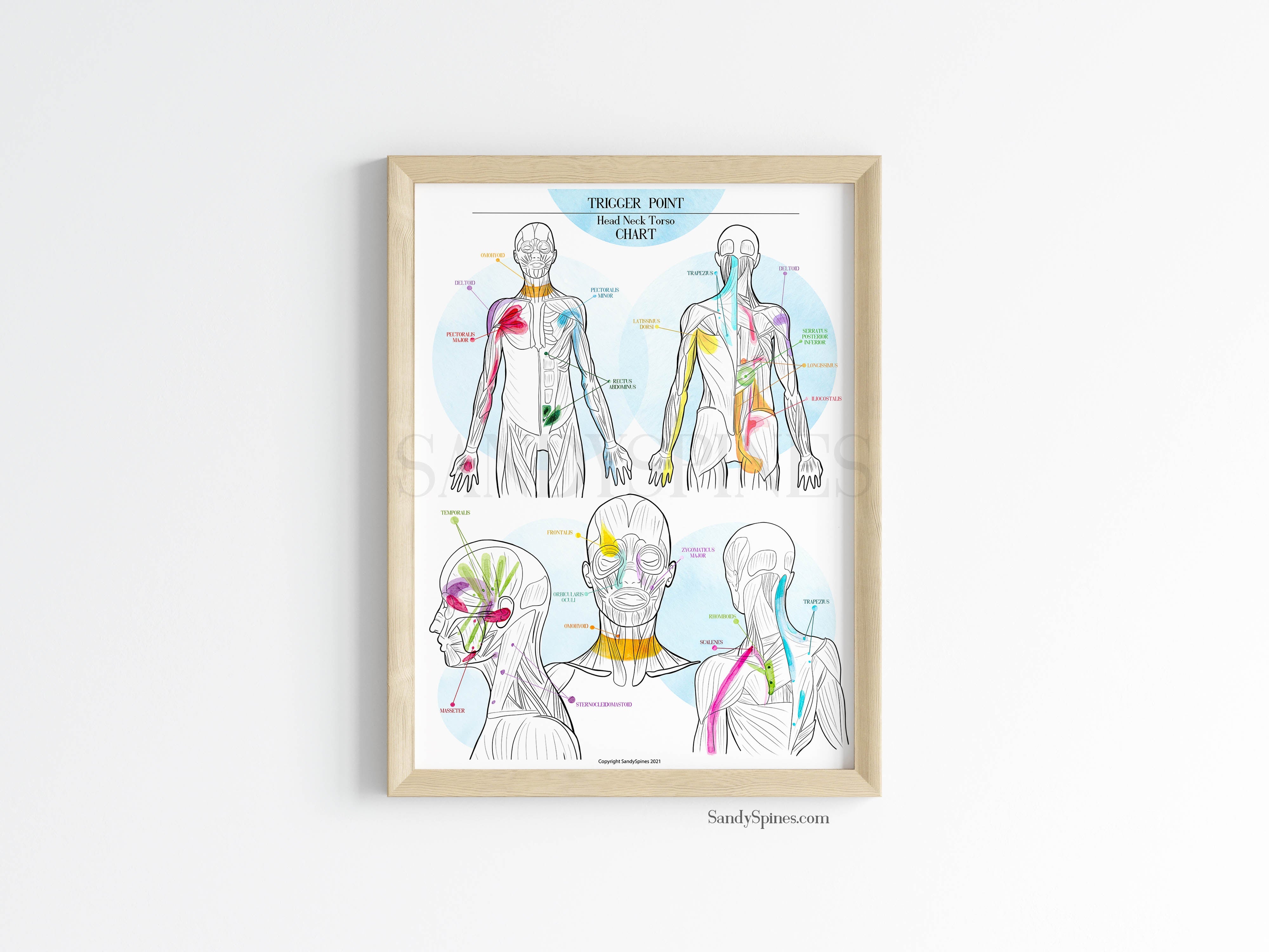 Trigger Point Charts | Set of 3 Posters – SandySpines