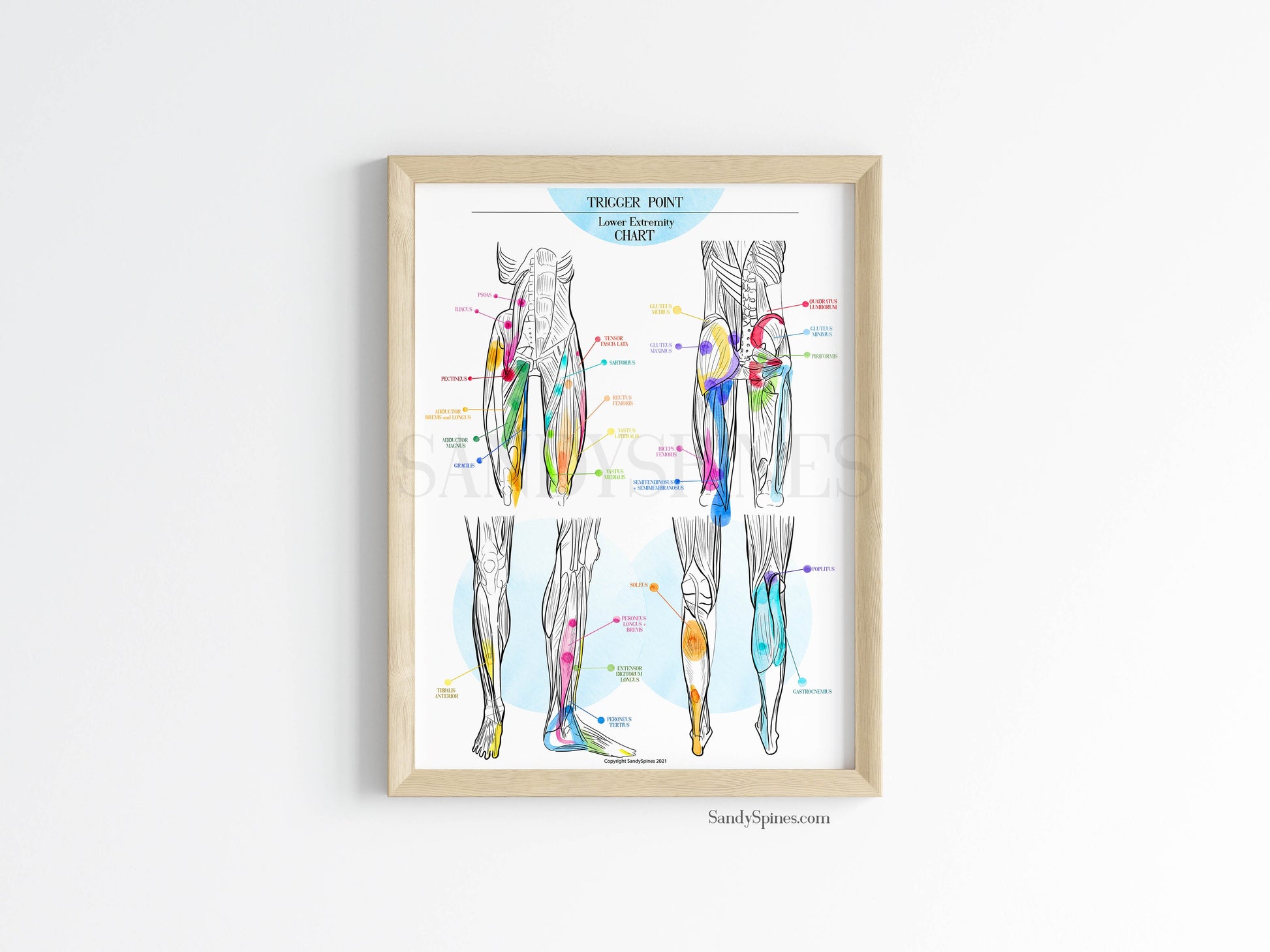 Trigger Point Charts | Set of 3 Posters – SandySpines